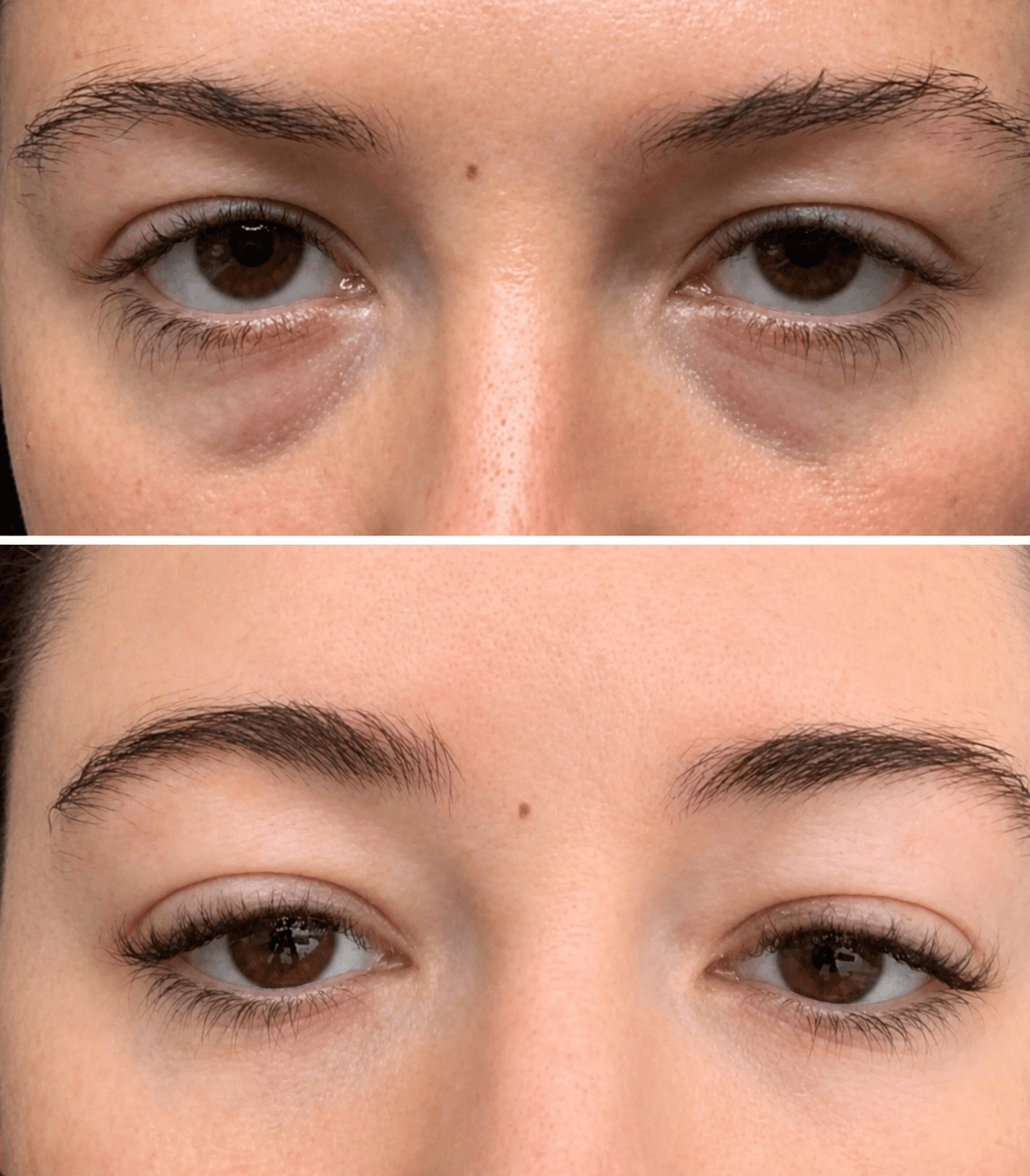 Alwora Eye Reset™
